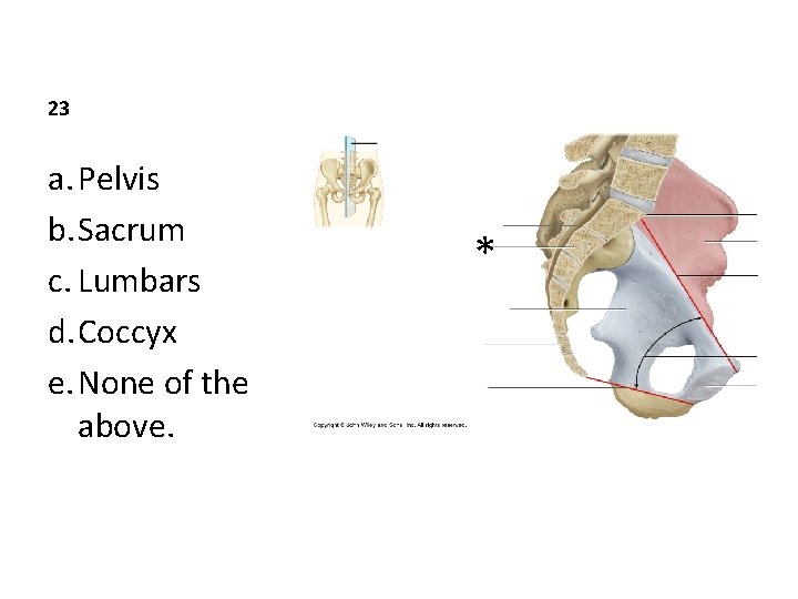 23 a. Pelvis b. Sacrum c. Lumbars d. Coccyx e. None of the above.