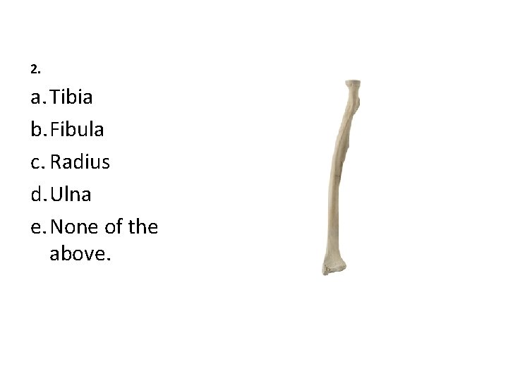 2. a. Tibia b. Fibula c. Radius d. Ulna e. None of the above.
