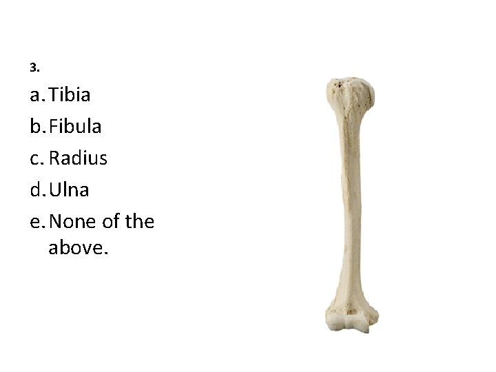 3. a. Tibia b. Fibula c. Radius d. Ulna e. None of the above.