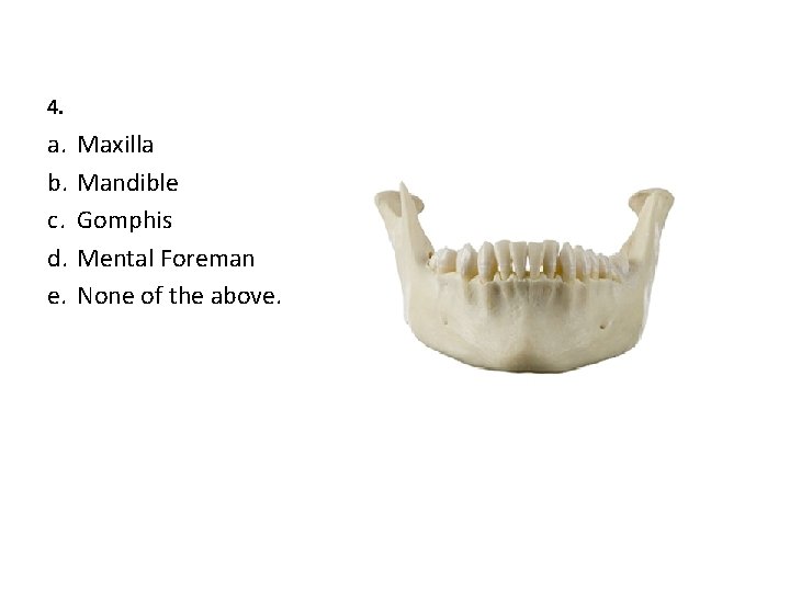 4. a. b. c. d. e. Maxilla Mandible Gomphis Mental Foreman None of the