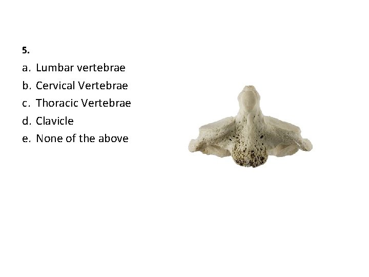 5. a. b. c. d. e. Lumbar vertebrae Cervical Vertebrae Thoracic Vertebrae Clavicle None