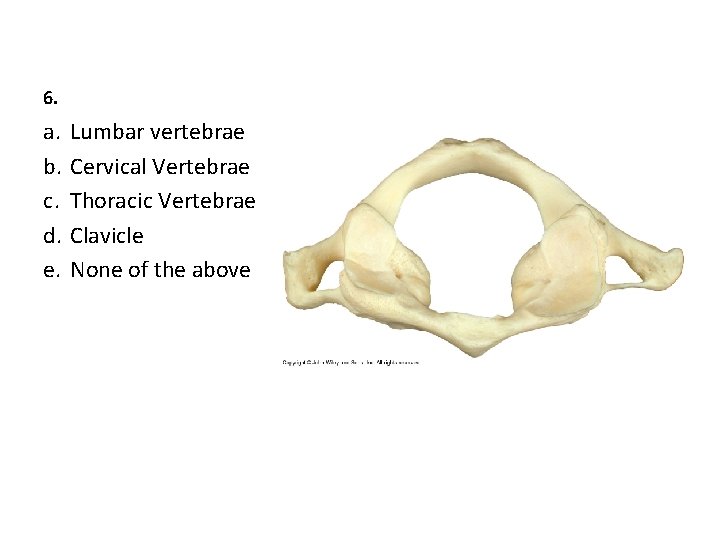 6. a. b. c. d. e. Lumbar vertebrae Cervical Vertebrae Thoracic Vertebrae Clavicle None