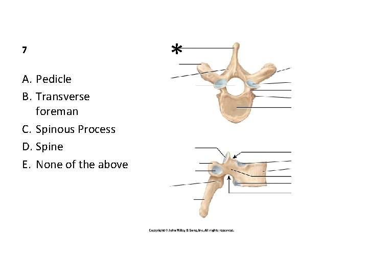 7 A. Pedicle B. Transverse foreman C. Spinous Process D. Spine E. None of