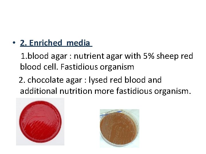 • 2. Enriched media 1. blood agar : nutrient agar with 5% sheep • 2. Enriched media 1. blood agar : nutrient agar with 5% sheep
