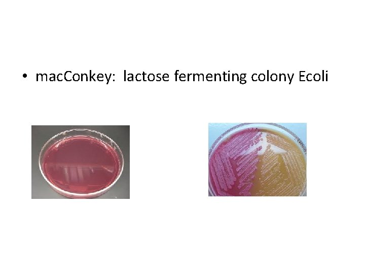  • mac. Conkey: lactose fermenting colony Ecoli 