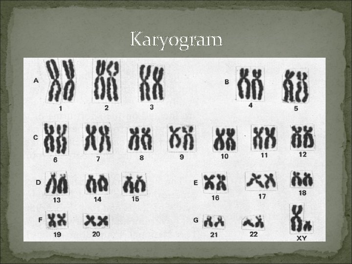 Karyogram 