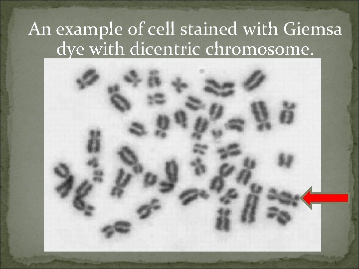 An example of cell stained with Giemsa dye with dicentric chromosome. 