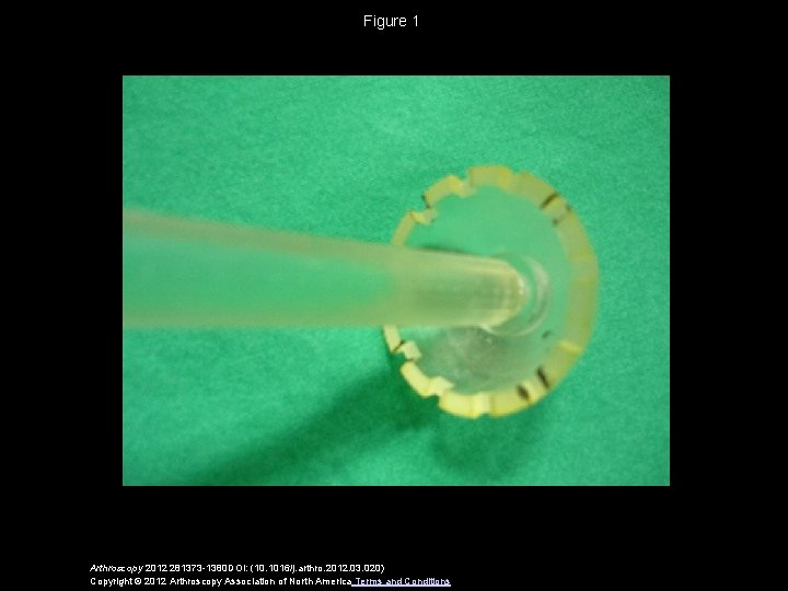 Figure 1 Arthroscopy 2012 281373 -1380 DOI: (10. 1016/j. arthro. 2012. 03. 020) Copyright