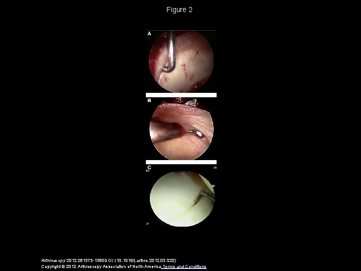 Figure 2 Arthroscopy 2012 281373 -1380 DOI: (10. 1016/j. arthro. 2012. 03. 020) Copyright