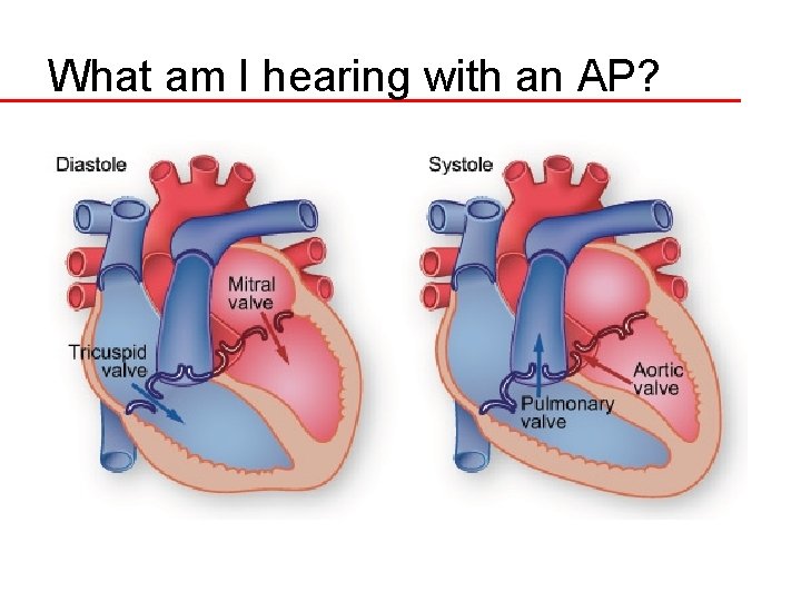 What am I hearing with an AP? 