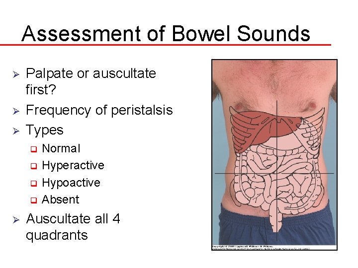 Assessment of Bowel Sounds Ø Ø Ø Palpate or auscultate first? Frequency of peristalsis