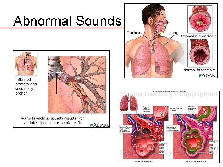 Abnormal Sounds 