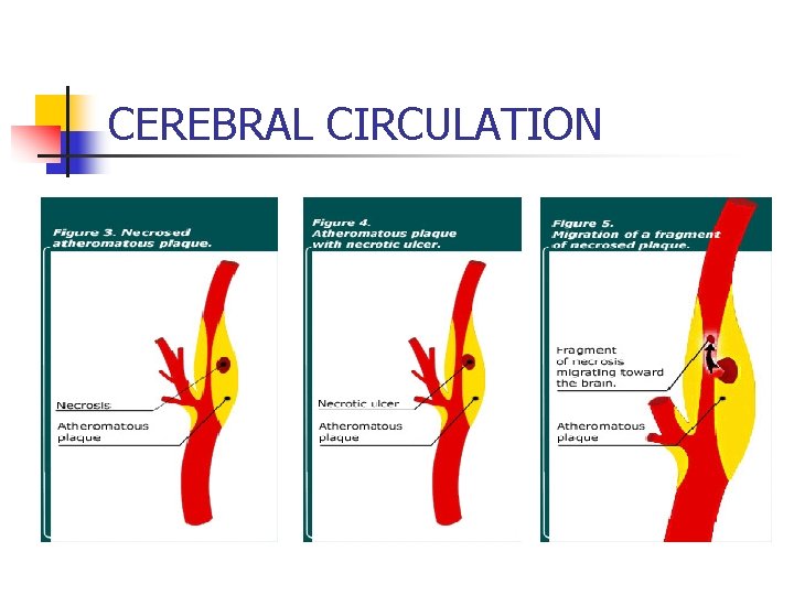 CEREBRAL CIRCULATION 