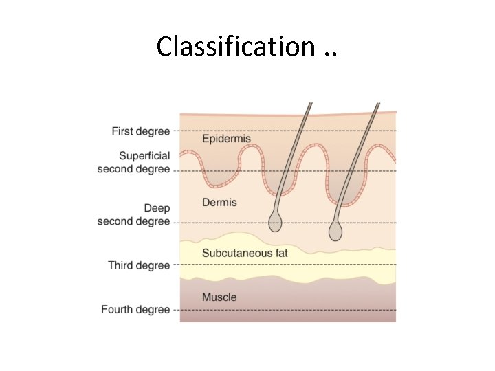 Classification. . 