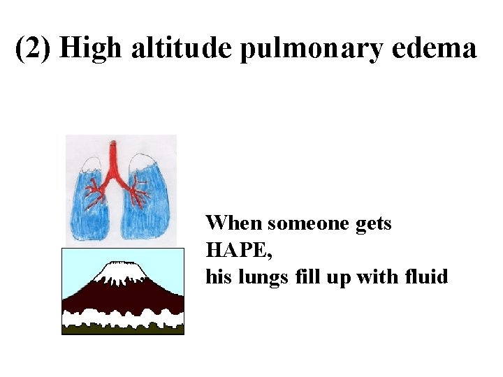 (2) High altitude pulmonary edema When someone gets HAPE, his lungs fill up with