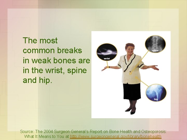 The most common breaks in weak bones are in the wrist, spine and hip.