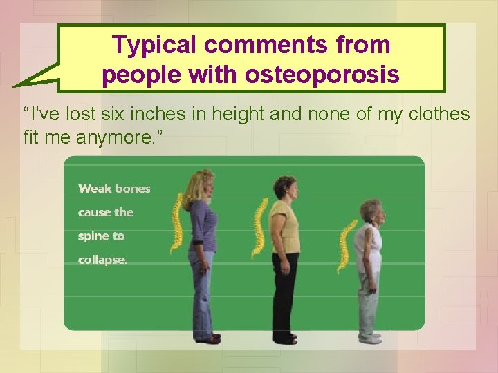 Typical comments from people with osteoporosis “I’ve lost six inches in height and none