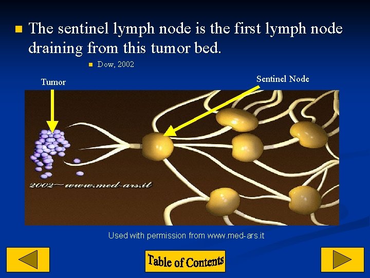 n The sentinel lymph node is the first lymph node draining from this tumor