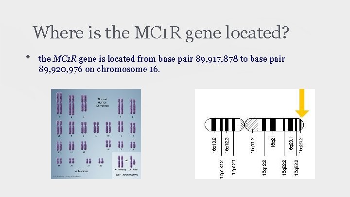 Where is the MC 1 R gene located? • the MC 1 R gene