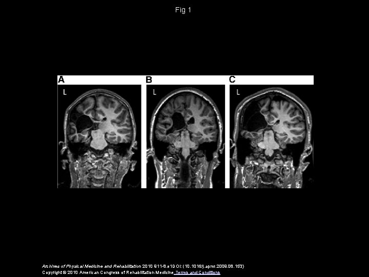 Fig 1 Archives of Physical Medicine and Rehabilitation 2010 911 -8. e 1 DOI: