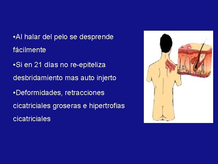  • Al halar del pelo se desprende fácilmente • Si en 21 días