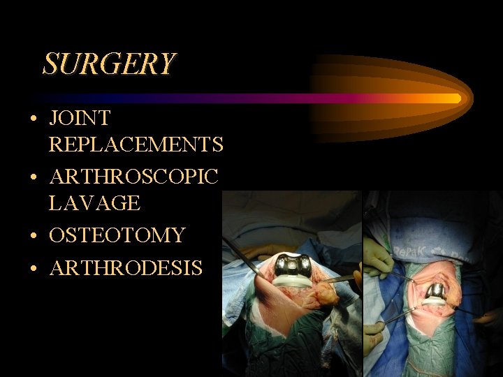 SURGERY • JOINT REPLACEMENTS • ARTHROSCOPIC LAVAGE • OSTEOTOMY • ARTHRODESIS 