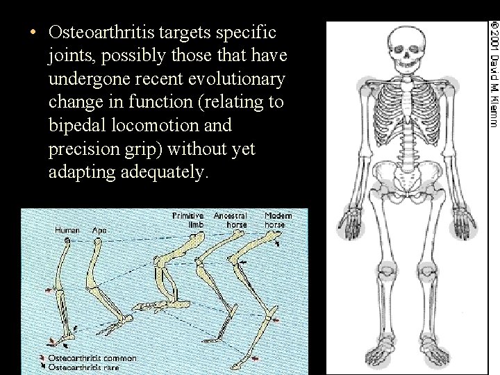  • Osteoarthritis targets specific joints, possibly those that have undergone recent evolutionary change