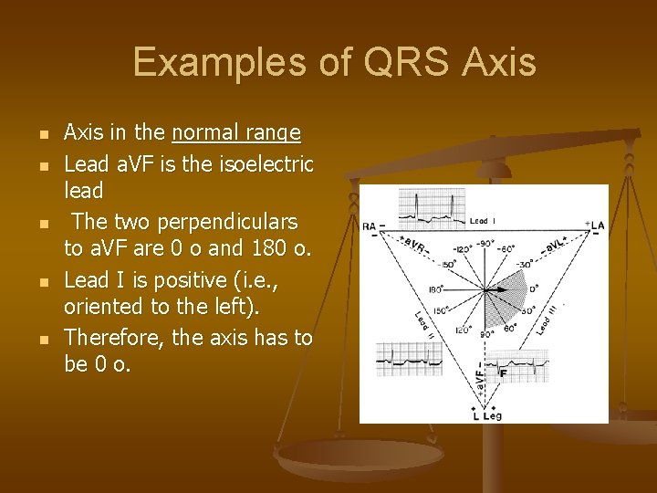  Examples of QRS Axis n n n Axis in the normal range Lead