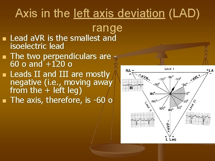 Axis in the left axis deviation (LAD) range n n Lead a. VR is