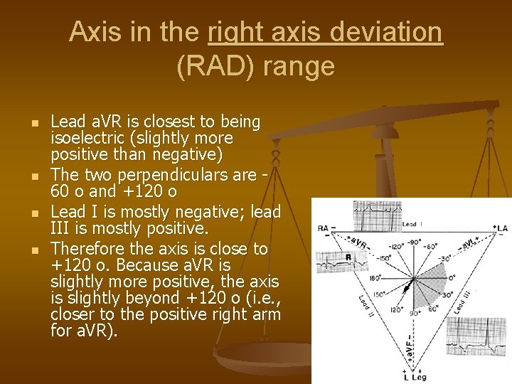 Axis in the right axis deviation (RAD) range n n Lead a. VR is