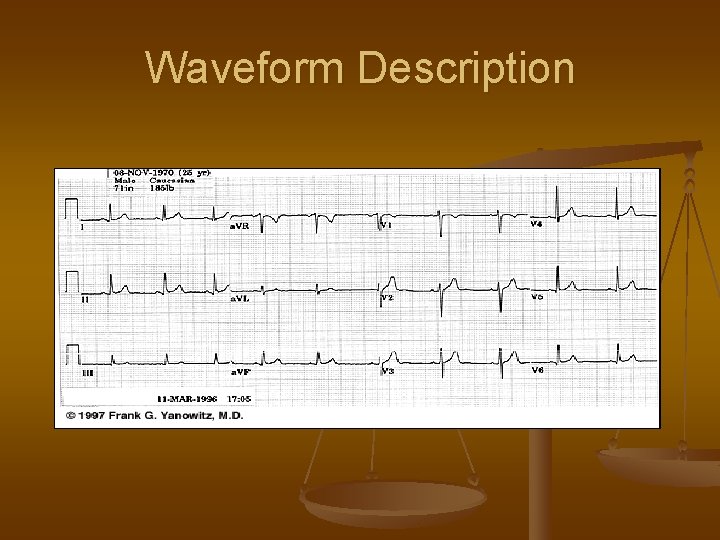 Waveform Description 