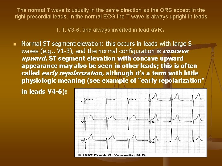 The normal T wave is usually in the same direction as the QRS except