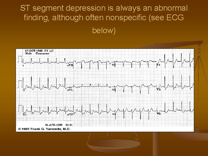ST segment depression is always an abnormal finding, although often nonspecific (see ECG below)