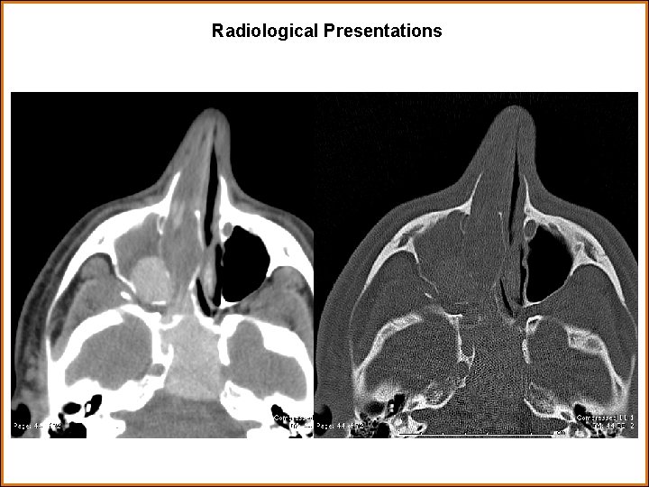 Radiological Presentations 