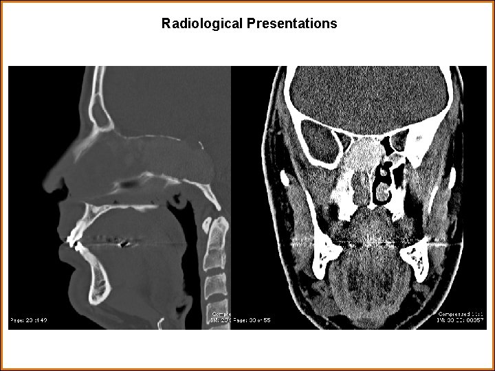 Radiological Presentations 