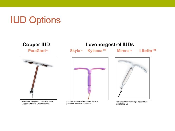 IUD Options 