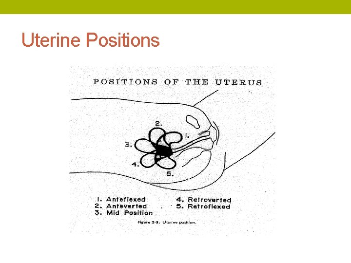 Uterine Positions 