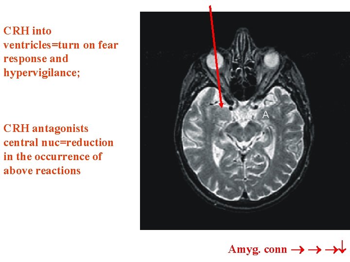 CRH into severe ventricles=turn on fear response and hypervigilance; CRH antagonists central nuc=reduction in