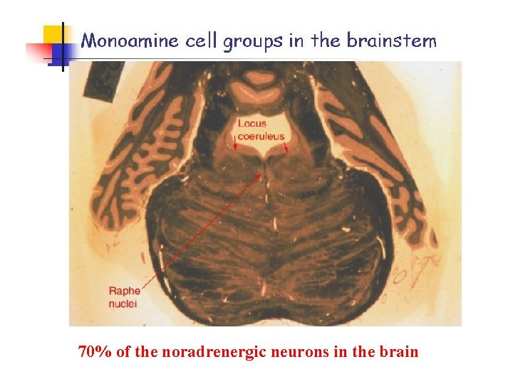70% of the noradrenergic neurons in the brain 