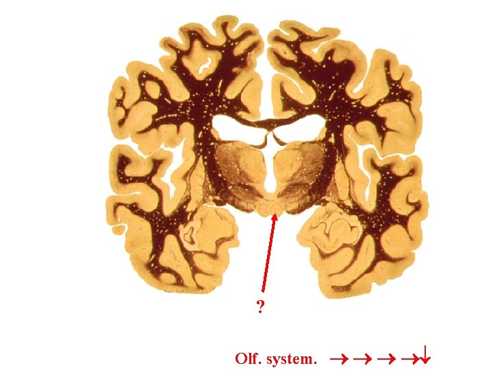 ? Olf. system. 