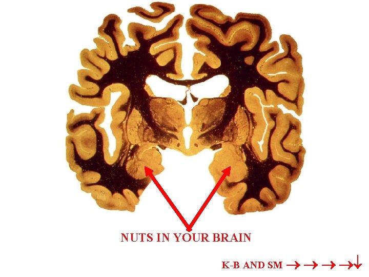 NUTS IN YOUR BRAIN K-B AND SM 