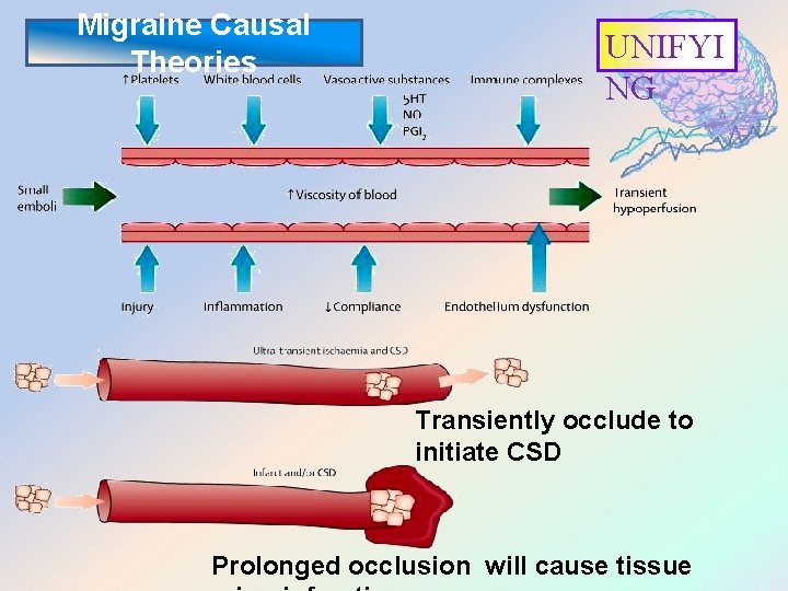 Migraine Causal Theories UNIFYI NG Transiently occlude to initiate CSD Prolonged occlusion will cause