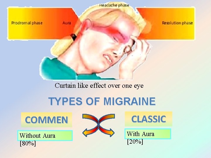 Curtain like effect over one eye TYPES OF MIGRAINE COMMEN Without Aura [80%] CLASSIC
