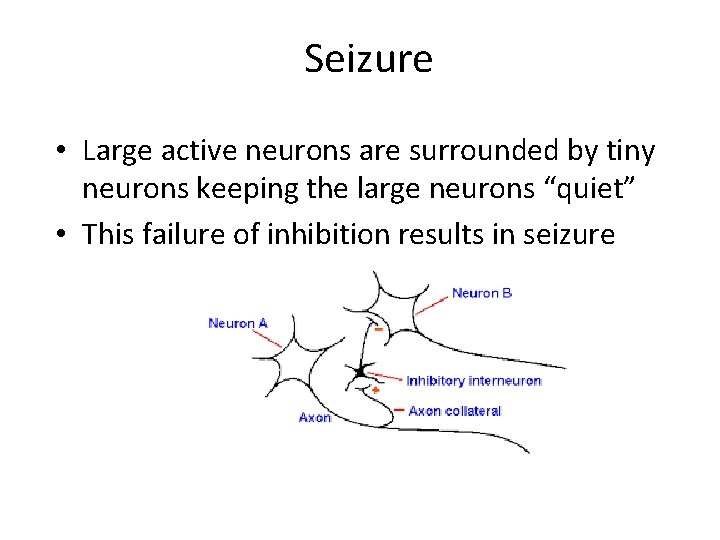 Seizure • Large active neurons are surrounded by tiny neurons keeping the large neurons