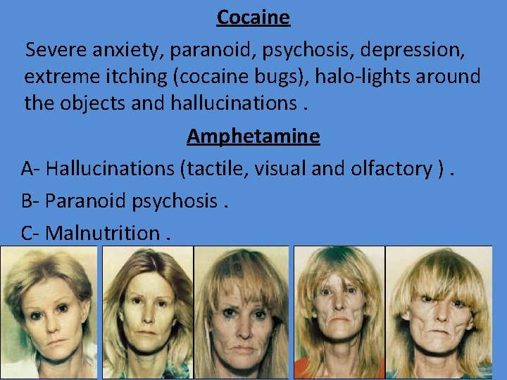 Cocaine Severe anxiety, paranoid, psychosis, depression, extreme itching (cocaine bugs), halo-lights around the objects