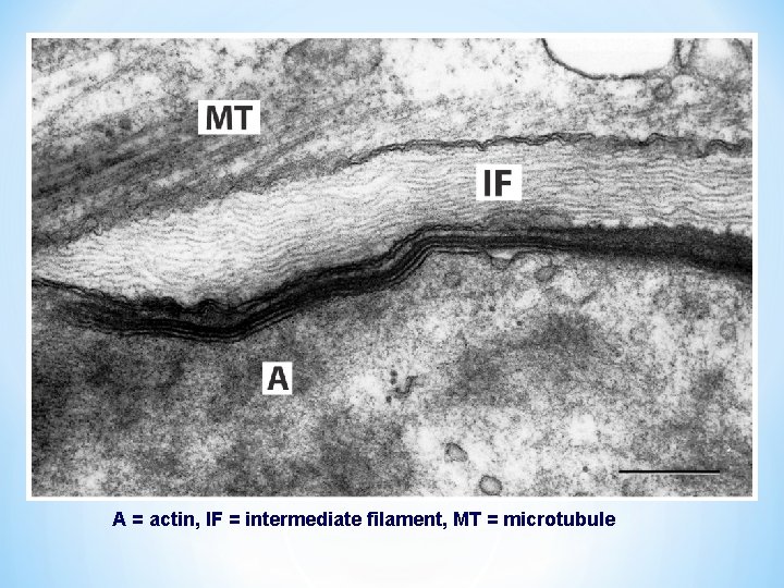 A = actin, IF = intermediate filament, MT = microtubule 