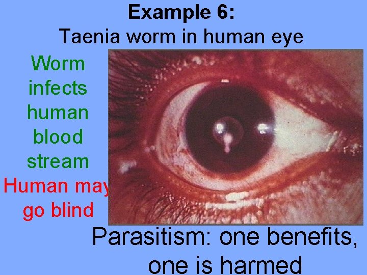 Example 6: Taenia worm in human eye Worm infects human blood stream Human may