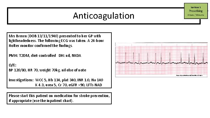 Anticoagulation Mrs Brown (DOB 13/11/1940) presented to her GP with lightheadedness. The following ECG