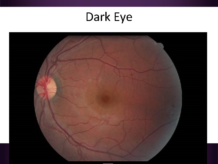 Dark Eye 