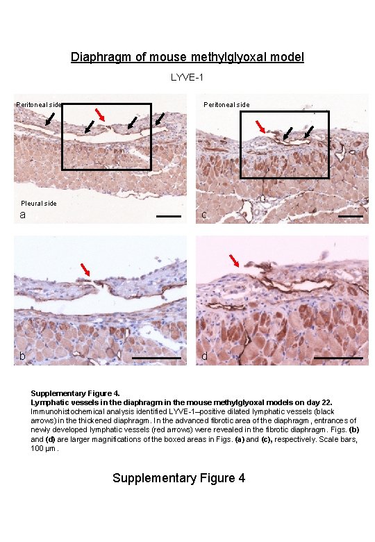 Diaphragm of mouse methylglyoxal model LYVE-1 Peritoneal side Pleural side a c b d